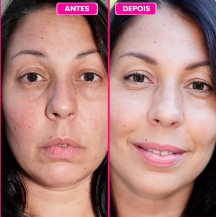 Dream Skin Care Funciona - Antes e depois