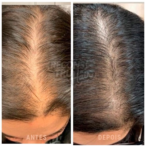 Reconstru Hair funciona - antes e depois