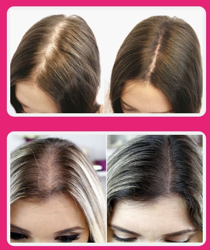 Melt Hair funciona - antes e depois 