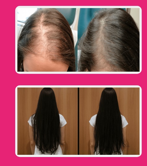 Melt Hair funciona - antes e depois 