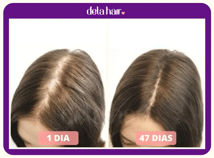 Dela Hair é bom? antes e depois do tratamento. imagens.